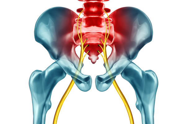 Anatomy of sciatica